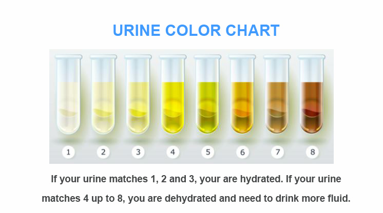 urine colors
